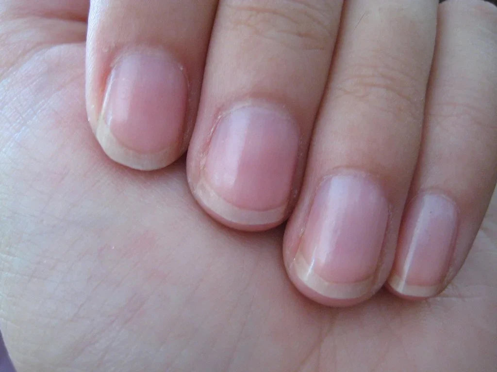 Fingernails