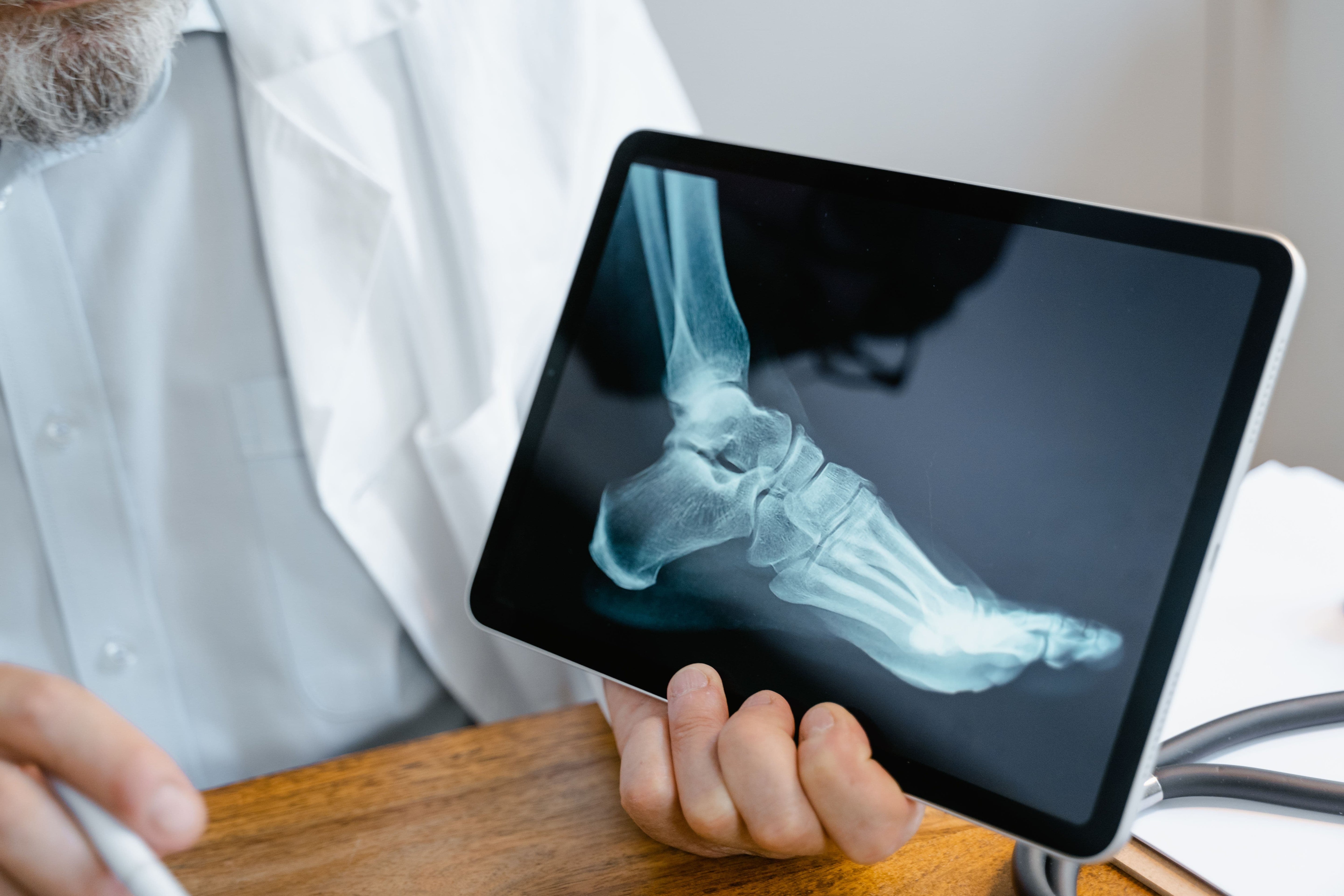 X-ray of the foot